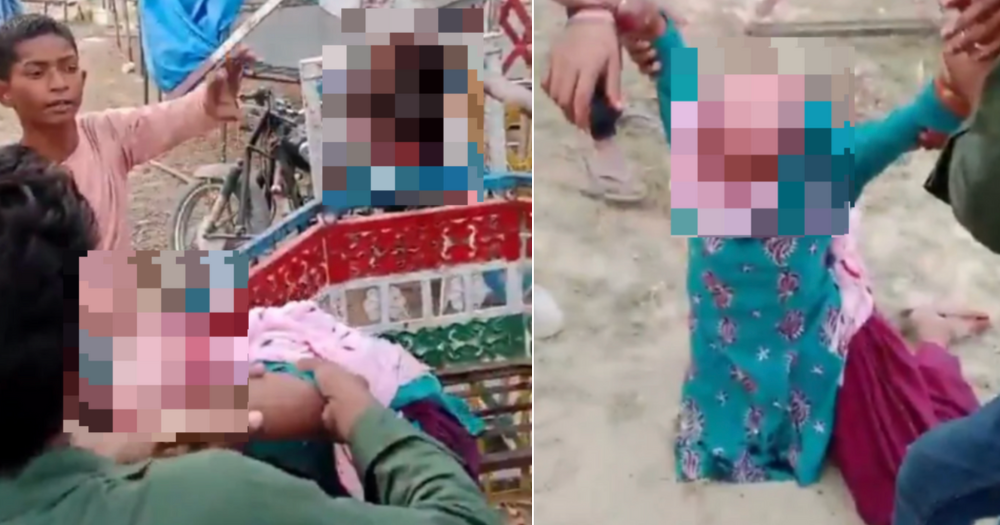 Girl in India gets scalp ripped off in ferris wheel freak accident