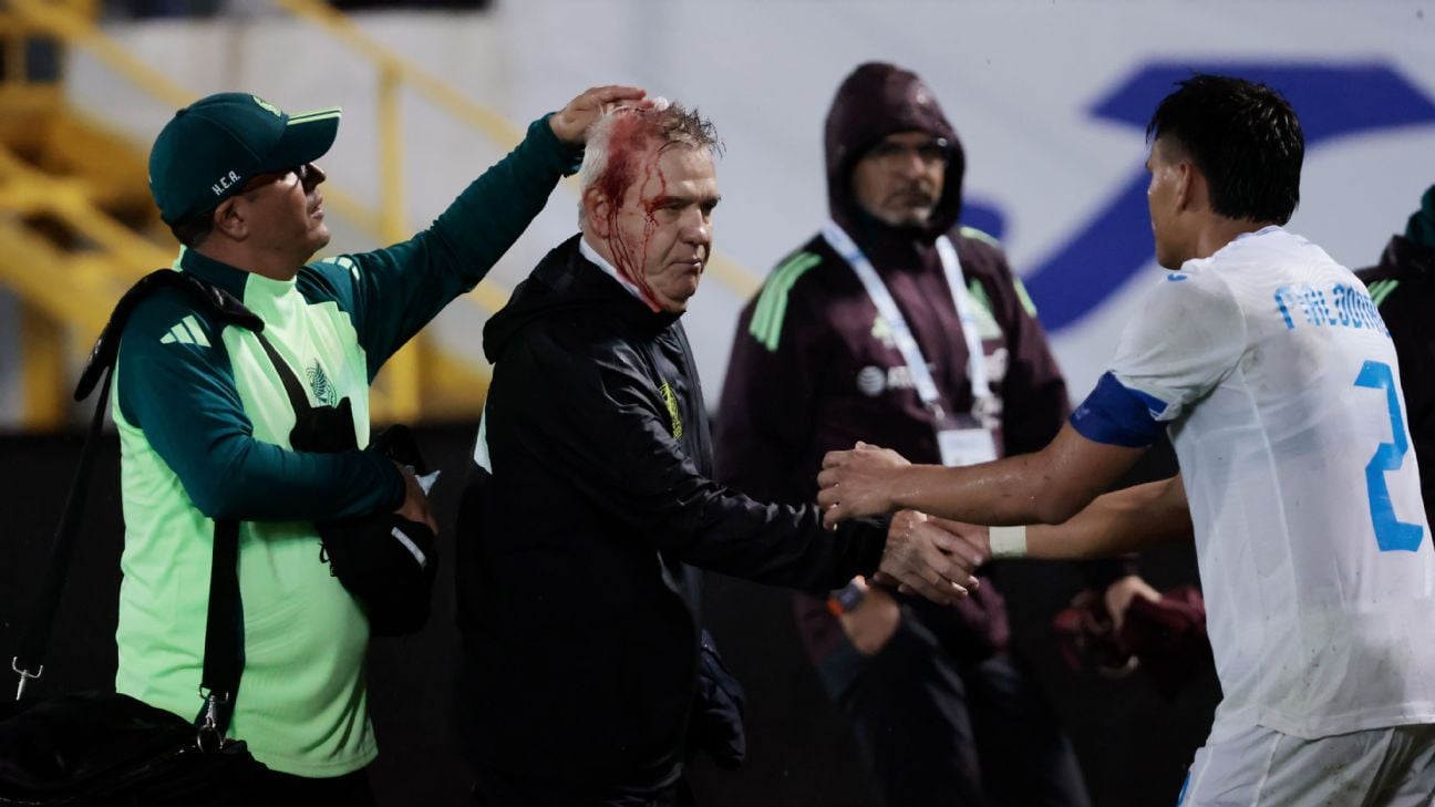 Mexico coach Aguirre hit in head by beer can after loss in Honduras