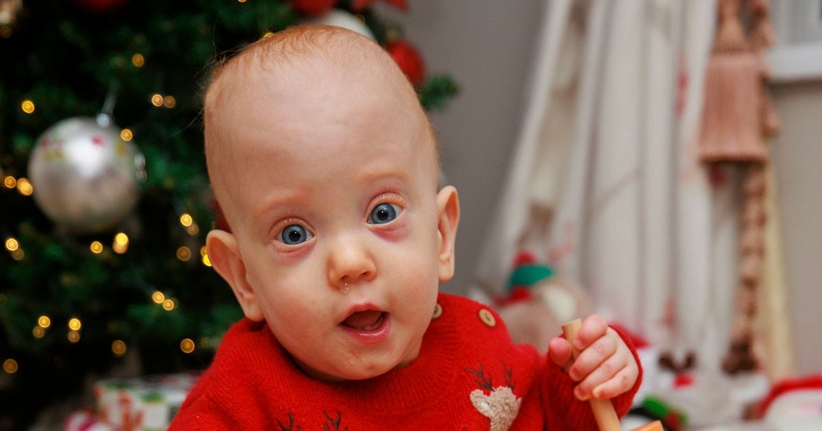 Miracle baby who weighed just 1lb 10oz set for first Christmas at home