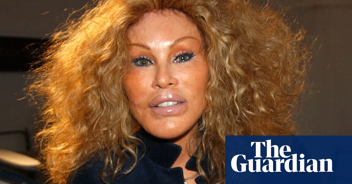 Jocelyne Wildenstein, socialite known for extreme cat-like plastic surgery, dies at 84