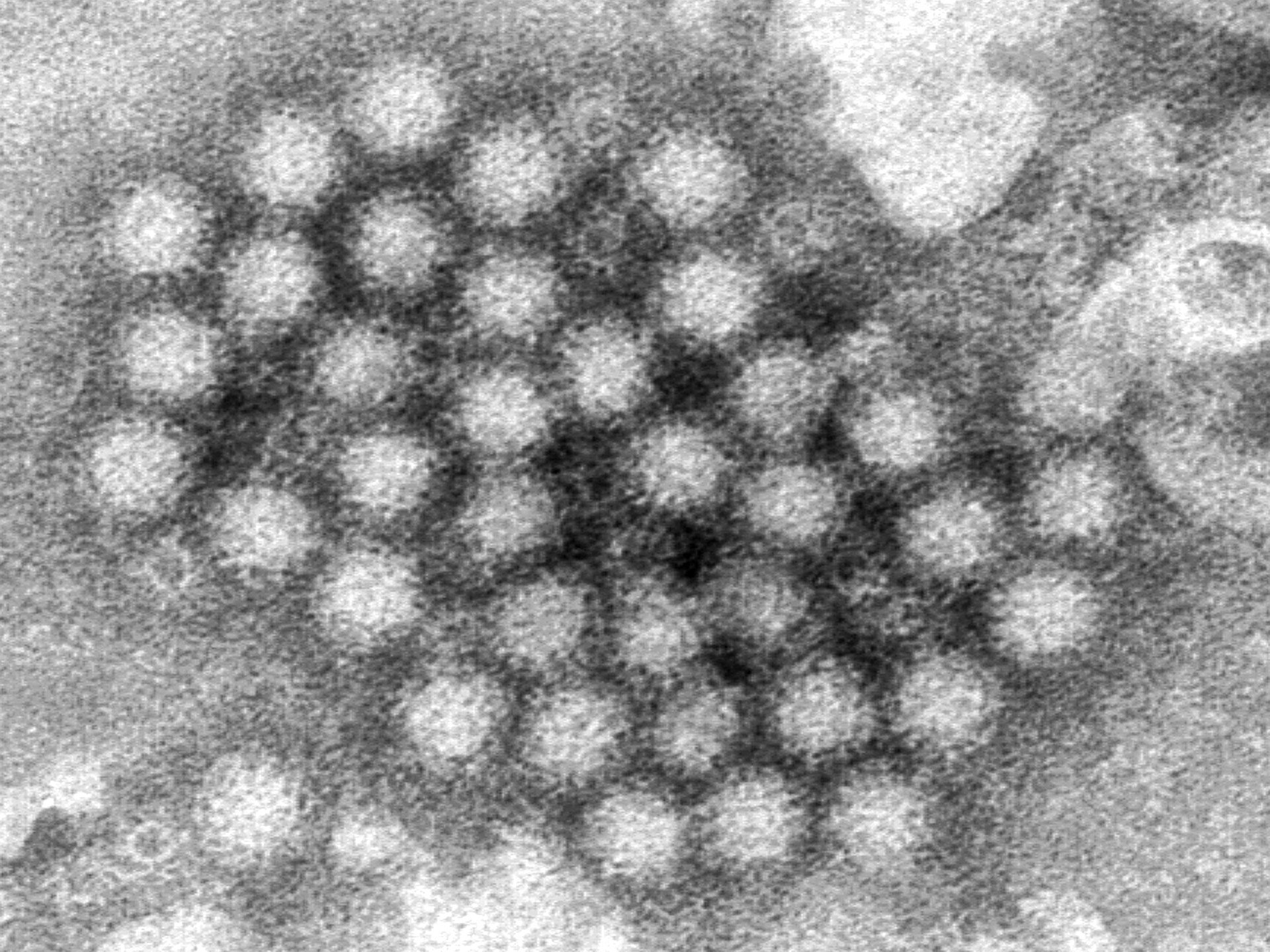 Norovirus is spiking in the US: What do we need to know?