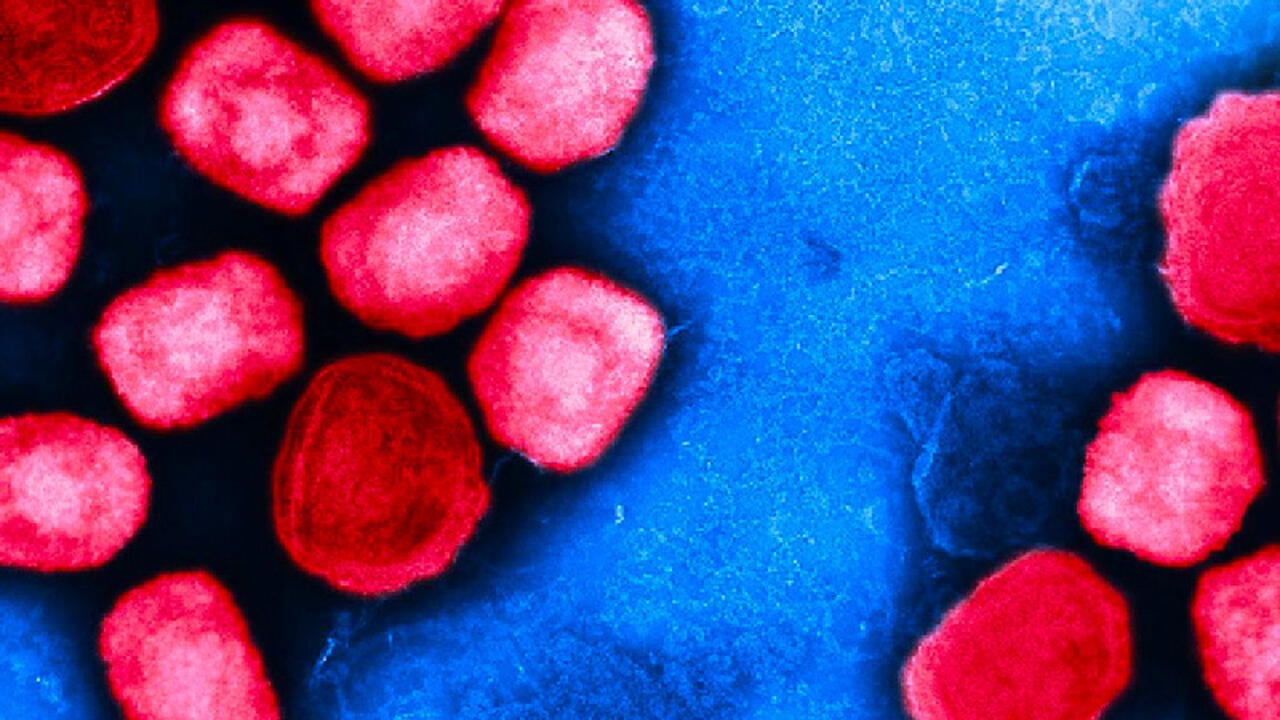 France confirms first case of new mpox virus amid WHO global alert