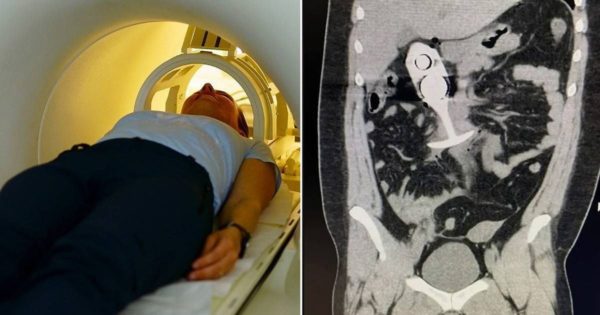 Woman writhes in agony as sex toy 'dragged through body' during intense MRI scan 